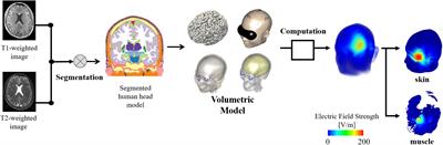 Dosimetry Analysis in Non-brain Tissues During TMS Exposure of Broca’s and M1 Areas